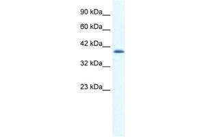 Western Blotting (WB) image for anti-Cation Channel, Sperm Associated 2 (CATSPER2) antibody (ABIN2461150) (CATSPER2 antibody)