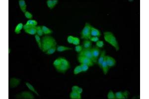 Immunofluorescence staining of PC-3 cells with ABIN7145758 at 1:100, counter-stained with DAPI. (BRAP antibody  (AA 13-124))