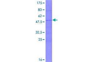 Chromosome 11 Open Reading Frame 88 (C11ORF88) (AA 1-178) protein (GST tag)