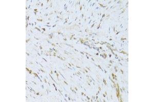 Immunohistochemistry (Paraffin-embedded Sections) (IHC (p)) image for anti-Apoptosis-Inducing Factor, Mitochondrion-Associated, 1 (AIFM1) (AA 334-613) antibody (ABIN3023385)