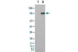 HEK293 overexpressing Human ENPP1 and probed with ENPP1 polyclonal antibody  (mock transfection in first lane) . (ENPP1 antibody  (C-Term))