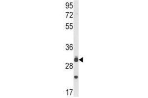 Western blot analysis of MyD88 antibody and mouse lung tissue lysate. (MYD88 antibody  (AA 136-164))