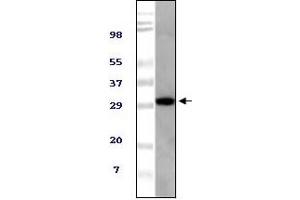 Western Blotting (WB) image for anti-Alveolar Soft Part Sarcoma Chromosome Region, Candidate 1 (ASPSCR1) (truncated) antibody (ABIN2464084)