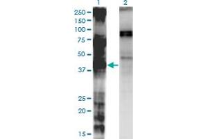 Western Blot analysis of LASS3 expression in transfected 293T cell line by LASS3 monoclonal antibody (M02), clone 6C12. (LASS3 antibody  (AA 57-134))