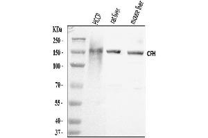 Western blot analysis of Factor H/CFH using anti-Factor H/CFH antibody (ABIN7599768).
