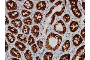 Immunoperoxidase of monoclonal antibody to CDH17 on formalin-fixed paraffin-embedded human small Intestine. (LI Cadherin antibody  (AA 24-131))