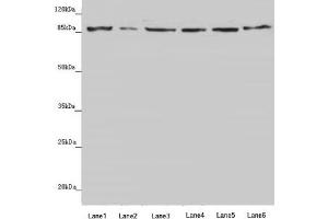 Western blot All lanes: YME1L1 antibody at 3. (YME1L1 antibody  (AA 1-240))
