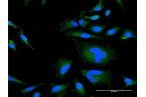 Immunofluorescence of purified MaxPab antibody to RGS21 on HeLa cell. (RGS21 antibody  (AA 1-152))
