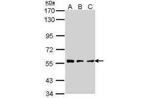 WB Image Sample (30 ug of whole cell lysate) A: A431 , B: H1299 C: Hela 7. (TPP1 antibody)