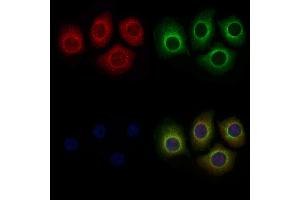 ABIN6259103 and ABIN6275220 staining Hela cells by IF/ICC.