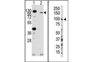 (LEFT) Western blot analysis of anti-hFGFR2-R22 Pab in 293 cell line lysates transiently transfected with the FGFR2 gene (2ug/lane). (FGFR2 antibody  (N-Term))
