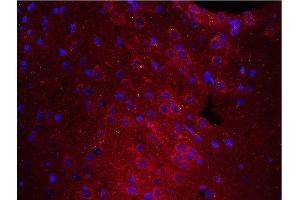 Formalin-fixed and paraffin embedded rat brain tissue labeled with Anti-PTPRA Polyclonal Antibody, unconjugated (ABIN754633) at 1:200 for 40 minutes at 37°C followed by labeling Rabbit Anti-Tubulin Beta, Cy3 conjugated 1:200, 40 minutes at 37° (PTPRA antibody  (AA 151-250))