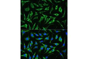 Immunofluorescence analysis of L929 cells using PAI-1/Serpin E1 antibody (ABIN6131330, ABIN6147601, ABIN6147603 and ABIN6221802) at dilution of 1:100. (PAI1 antibody  (AA 24-402))