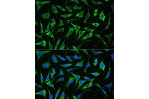 Immunofluorescence analysis of L929 cells using PAI-1/Serpin E1 antibody (ABIN6131330, ABIN6147601, ABIN6147603 and ABIN6221802) at dilution of 1:100.