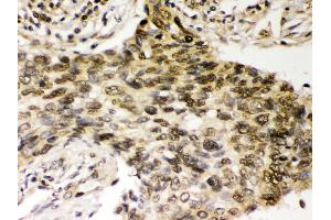 Immunohistochemistry (Paraffin-embedded Sections) (IHC (p)) image for anti-Checkpoint Kinase 2 (CHEK2) (AA 465-498), (C-Term) antibody (ABIN3043811) (CHEK2 antibody  (C-Term))