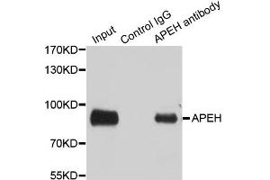 Immunoprecipitation analysis of 100ug extracts of SW480 cells using 3ug APEH antibody (ABIN1980260).