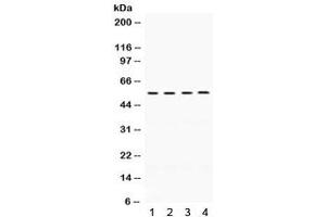 Western blot testing of human 1) A549, 2) HeLa, 3) MCF7, 4) SW620 cell lysate with FMO2 antibody. (FMO2 antibody)