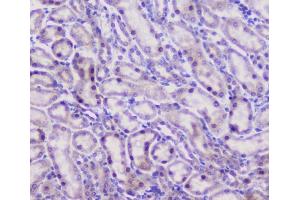 IHC analysis of CFP using anti-CFP antibody (ABIN6719298). (CFP antibody)