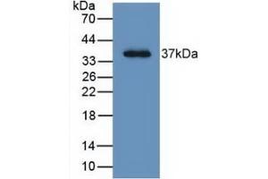 Detection of Recombinant LRG1, Human using Monoclonal Antibody to Leucine Rich Alpha-2-Glycoprotein 1 (LRG1) (LRG1 antibody  (AA 37-340))