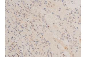 Immunohistochemistry (IHC) image for anti-Tumor Protein P53 (TP53) (acLys319) antibody (ABIN6254862)