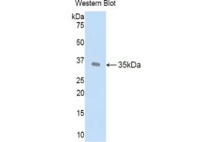 Western blot analysis of the recombinant protein. (LEFTY1 antibody  (AA 78-361))