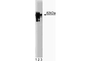Western blot analysis of gamma-Catenin on a HeLa lysate. (JUP antibody  (AA 553-738))