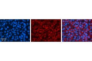 PAPSS2 antibody - C-terminal region          Formalin Fixed Paraffin Embedded Tissue:  Human Liver Tissue    Observed Staining:  Cytoplasm in hepatocytes   Primary Antibody Concentration:  1:100    Other Working Concentrations:  1/600    Secondary Antibody:  Donkey anti-Rabbit-Cy3    Secondary Antibody Concentration:  1:200    Magnification:  20X    Exposure Time:  0.
