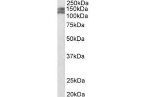 AP31771PU-N PARD3B antibody staining of Mouse fetal Kidney lysate at 0. (PARD3B antibody  (C-Term))