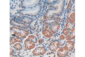 Figure. (CCBL1 antibody  (AA 1-422))