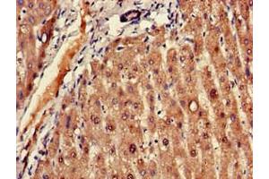 Immunohistochemistry of paraffin-embedded human liver tissue using ABIN7152606 at dilution of 1:100