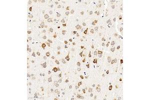 Immunohistochemistry of paraffin embedded mouse brain using CHST6 (ABIN7073302) at dilution of 1:2000 (300x lens) (CHST6 antibody)