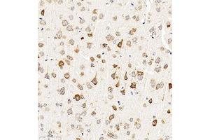 Immunohistochemistry of paraffin embedded mouse brain using CHST6 (ABIN7073302) at dilution of 1:2000 (300x lens) (CHST6 antibody)