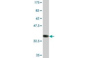 Western Blot detection against Immunogen (36. (DIRAS3 antibody  (AA 130-229))