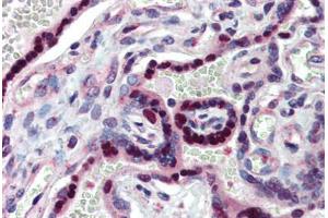 Immunohistochemistry (Paraffin-embedded Sections) (IHC (p)) image for anti-Nuclear Receptor Subfamily 2, Group E, Member 1 (NR2E1) (AA 95-144) antibody (ABIN6741553)