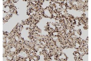 ABIN6273020 at 1/100 staining Rat lung tissue by IHC-P. (TIA1 antibody  (Internal Region))