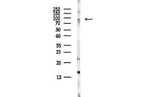 anti-DAG Kinase gamma antibody