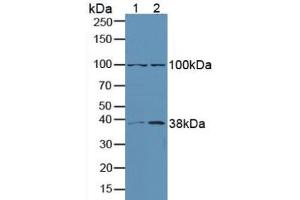 Western blot analysis of (1) Human A549 Cells and (2) Human Lung Tissue.