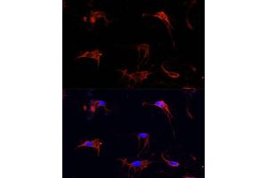 Immunofluorescence analysis of C6 cells using FBN1 Polyclonal Antibody (ABIN7267176) at dilution of 1:100 (40x lens). (Fibrillin 1 antibody  (AA 360-460))