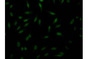Immunofluorescence staining of Hela Cells with ABIN7127663 at 1:50, counter-stained with DAPI. (Recombinant PAK1 antibody)