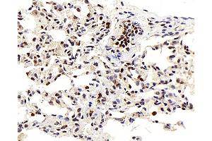 Immunohistochemistry analysis of paraffin-embedded Rat lung using LEP Polyclonal Antibody at dilution of 1:100. (Leptin antibody)