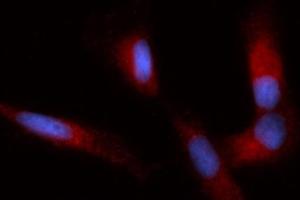 Immunofluorescence (IF) image for anti-Immunoglobulin Binding Protein (BIP) (AA 20-650) antibody (PE) (ABIN5566443) (BIP antibody  (AA 20-650) (PE))