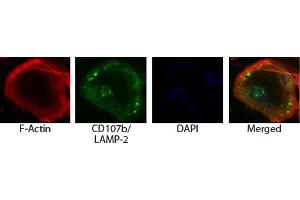 Osteoclasts from ashen mice were stained with AF594 conjugated phalloidin and Rat Anti-Mouse CD107b-UNLB (LAMP2 antibody)