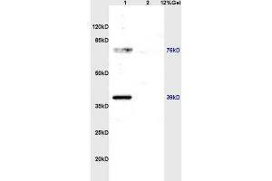 Lane 1: rat brain lysates Lane 2: rat kidney lysates probed with Anti ZNF185 Polyclonal Antibody, Unconjugated (ABIN762716) at 1:200 in 4 °C. (Zinc Finger Protein 185 antibody  (AA 551-650))