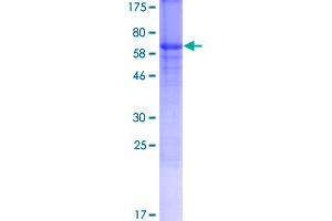 Image no. 1 for Zona Pellucida Glycoprotein 3 (ZP3) (AA 1-373) protein (GST tag) (ABIN1326505)