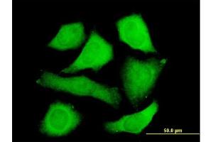 Immunofluorescence of purified MaxPab antibody to STIP1 on HeLa cell. (STIP1 antibody  (AA 1-543))