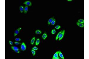 Immunofluorescent analysis of HepG2 cells using ABIN7149960 at dilution of 1:100 and Alexa Fluor 488-congugated AffiniPure Goat Anti-Rabbit IgG(H+L) (FMO4 antibody  (AA 1-300))