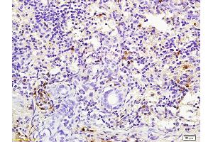 Formalin-fixed and paraffin embedded mouse lung labeled with Rabbit Anti pro-caspase-3 Polyclonal Antibody, Unconjugated (ABIN747728) at 1:200 followed by conjugation to the secondary antibody and DAB staining