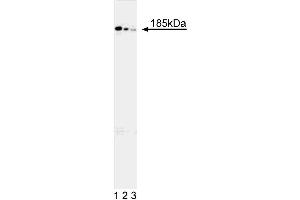 Western blot analysis of human DCC protein in 293 human embryonic kidney cells stably transfected with an expression vector containing full length DCC cDNA.