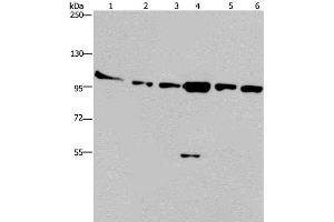 Western Blot analysis of Human testis tissue, K562, A549, Raji, NIH/3T3 and Hela cell using PRKD3 Polyclonal Antibody at dilution of 1:200 (PRKD3 antibody)