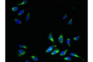Immunofluorescent analysis of Hela cells using ABIN7164554 at dilution of 1:100 and Alexa Fluor 488-congugated AffiniPure Goat Anti-Rabbit IgG(H+L) (SLC31A2 antibody  (AA 44-93))